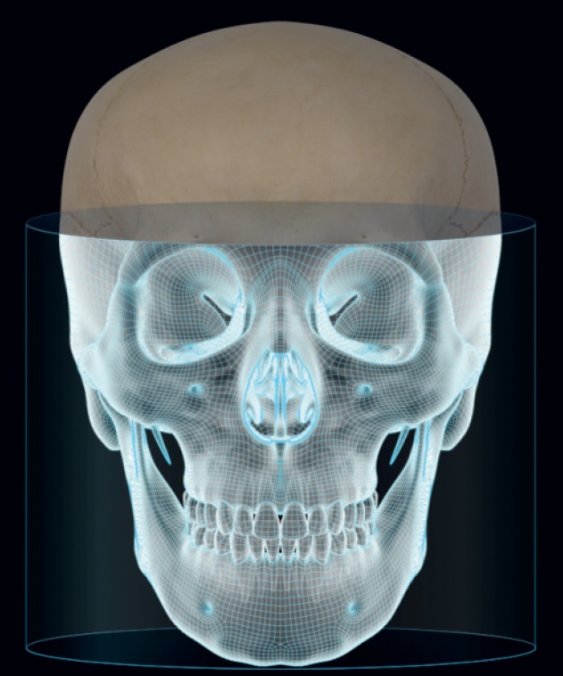 FOV 15×15 (stitching)